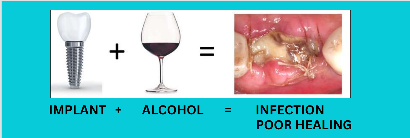 Doctor, When Can I Drink Alcohol AfterDental Implant Surgery”?