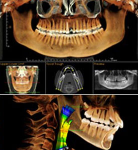 CT scan technology